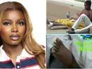 “This thing is getting serious” – Isabella’s leg injury worsens as she gets bandaged, walking stick provided (Video)