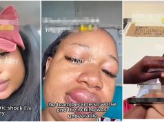 New mom reveals type of animal that was pressed out of her swollen lips after days of pain (Video)