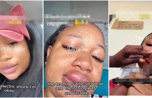 New mom reveals type of animal that was pressed out of her swollen lips after days of pain (Video)